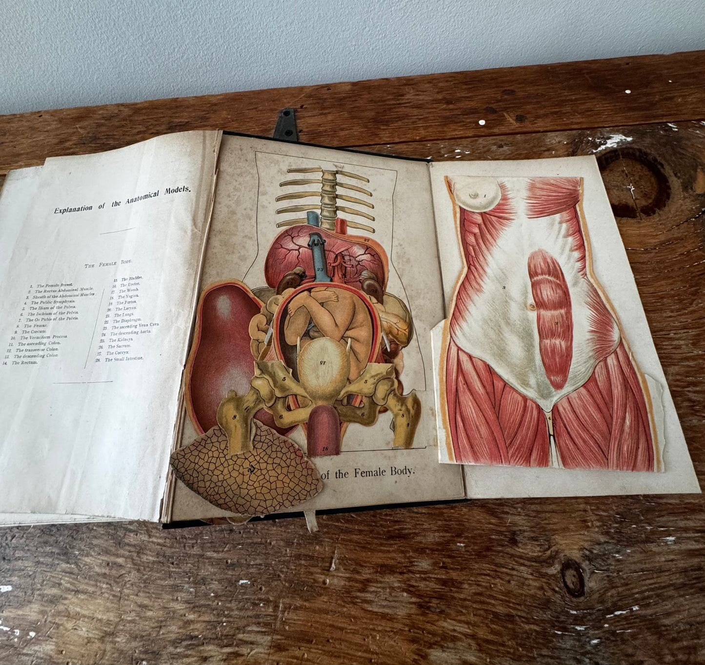 The Household Medical Advisor by Muller, MD 1900s Book Illustrated