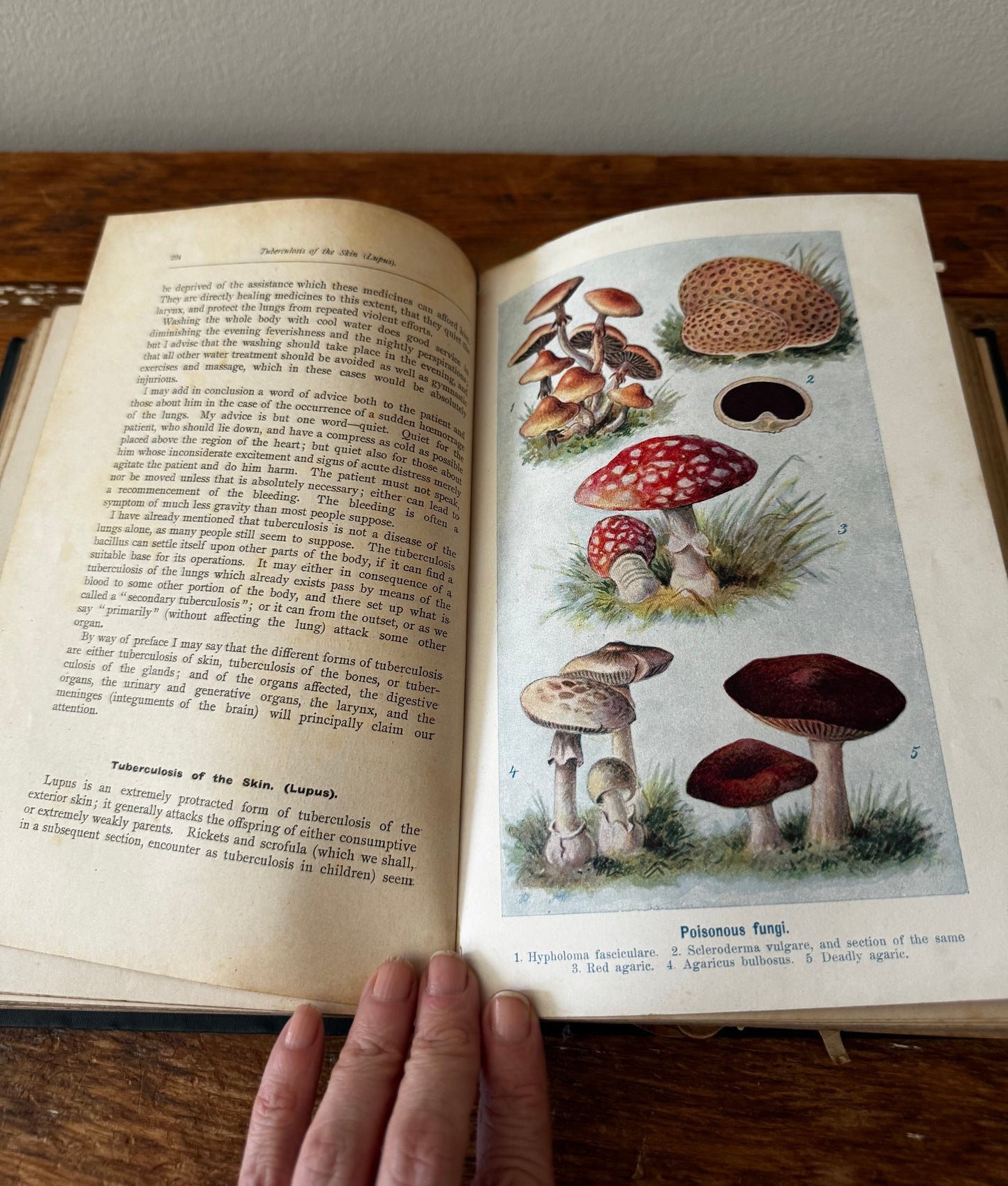 The Household Medical Advisor by Muller, MD 1900s Book Illustrated